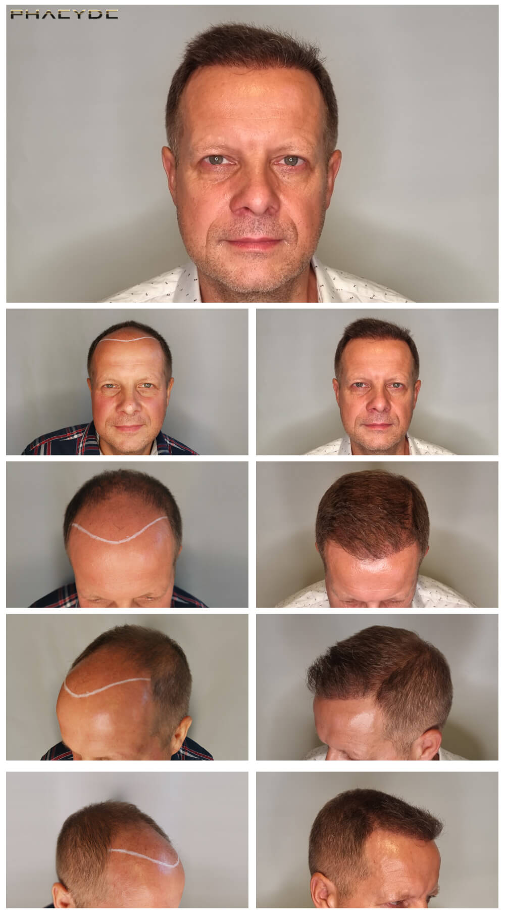 Marcel – 2600 Enten